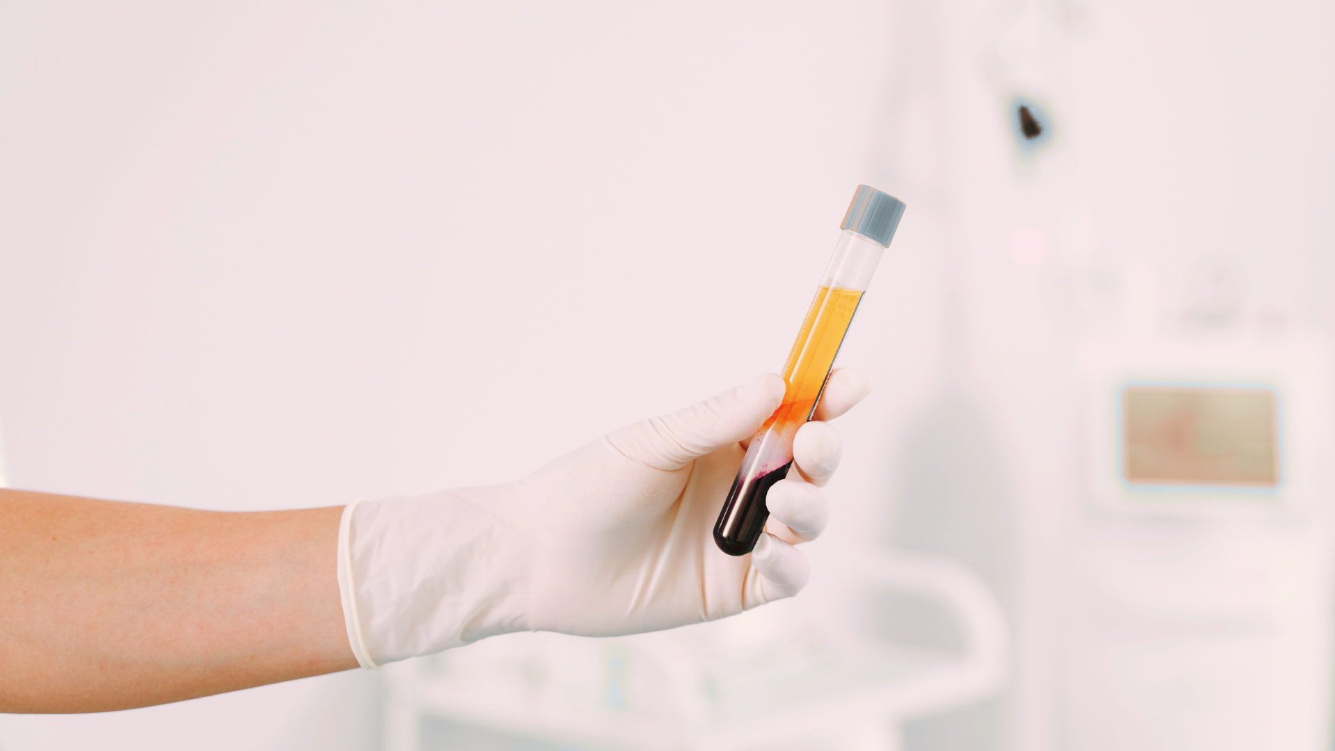 Microneedling - Dermapen 2 Injection PRP Vampire Lift Geneve Dr Thomet