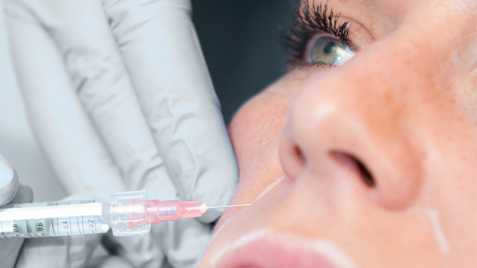 Injections acide hyaluronique Geneve Dr Thomet 1