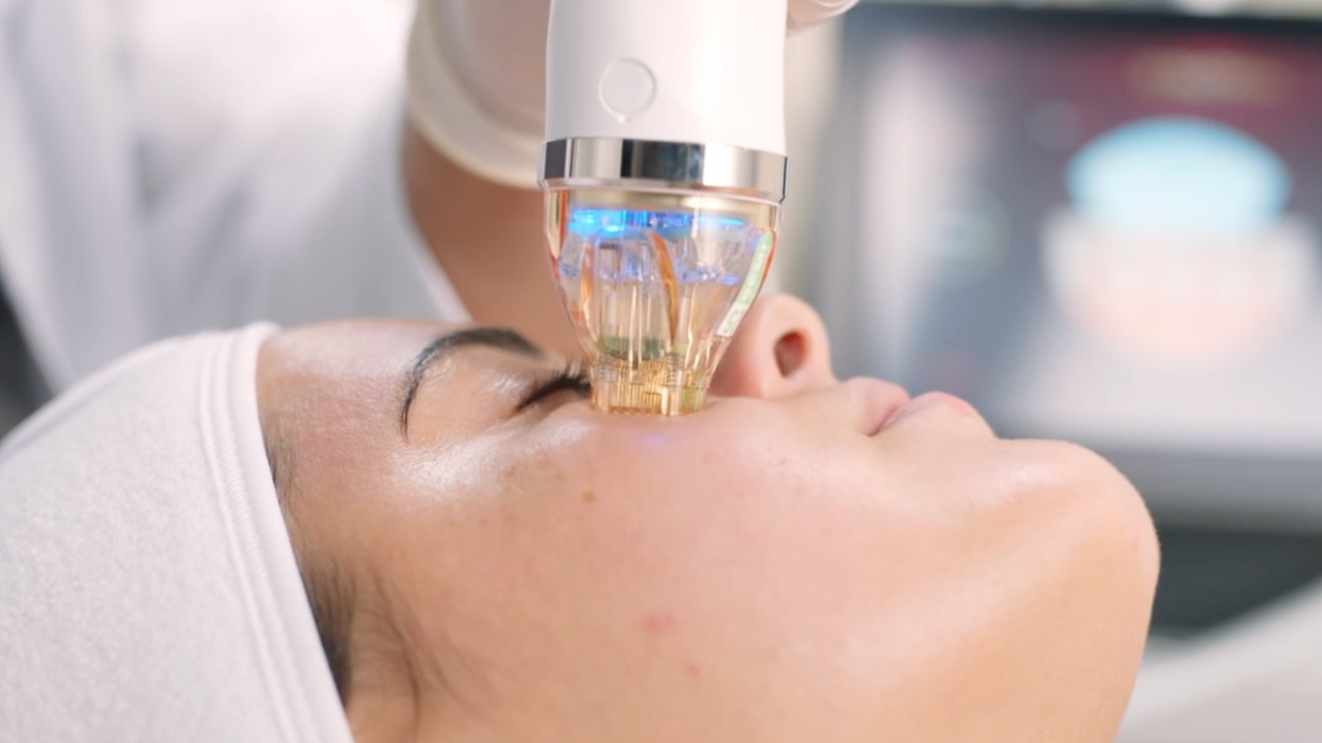 Microneedling radiofrequence Secret pro